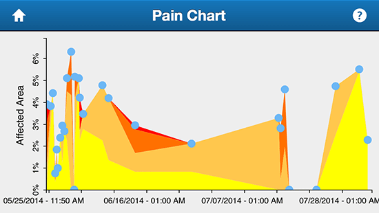 Shin Splints Stat Graph Shin stories | Team Consulting