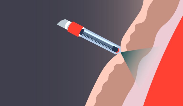 Free Needle Injection Model Preparing for mass vaccination | Team Consulting