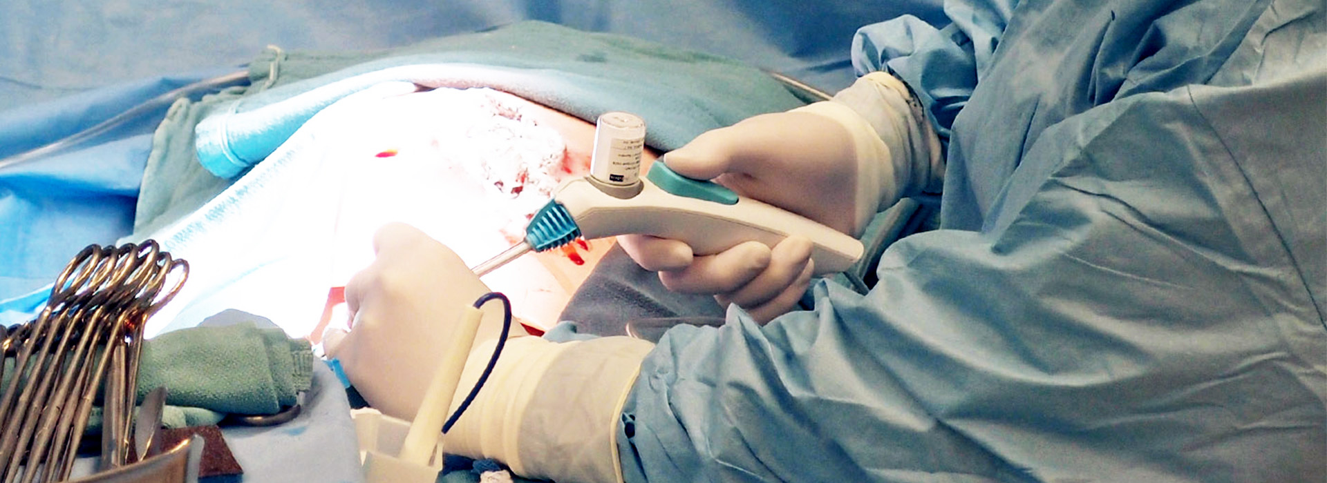 surgical-haemostat-delivery-device-trials