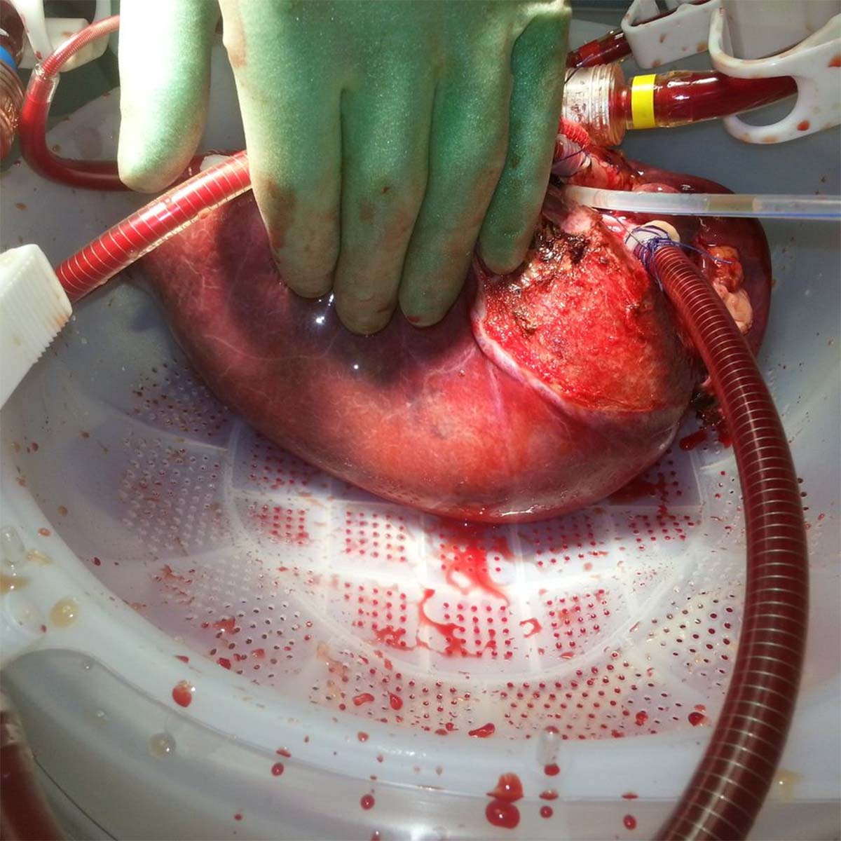 16568_Liver_device_OrganOx3