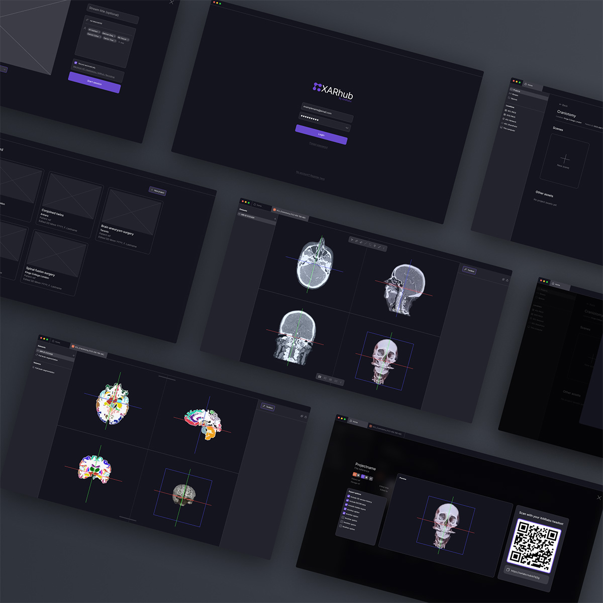 App screens showing neurosurgical planning prototype