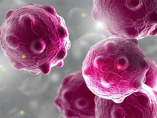 tumour cells