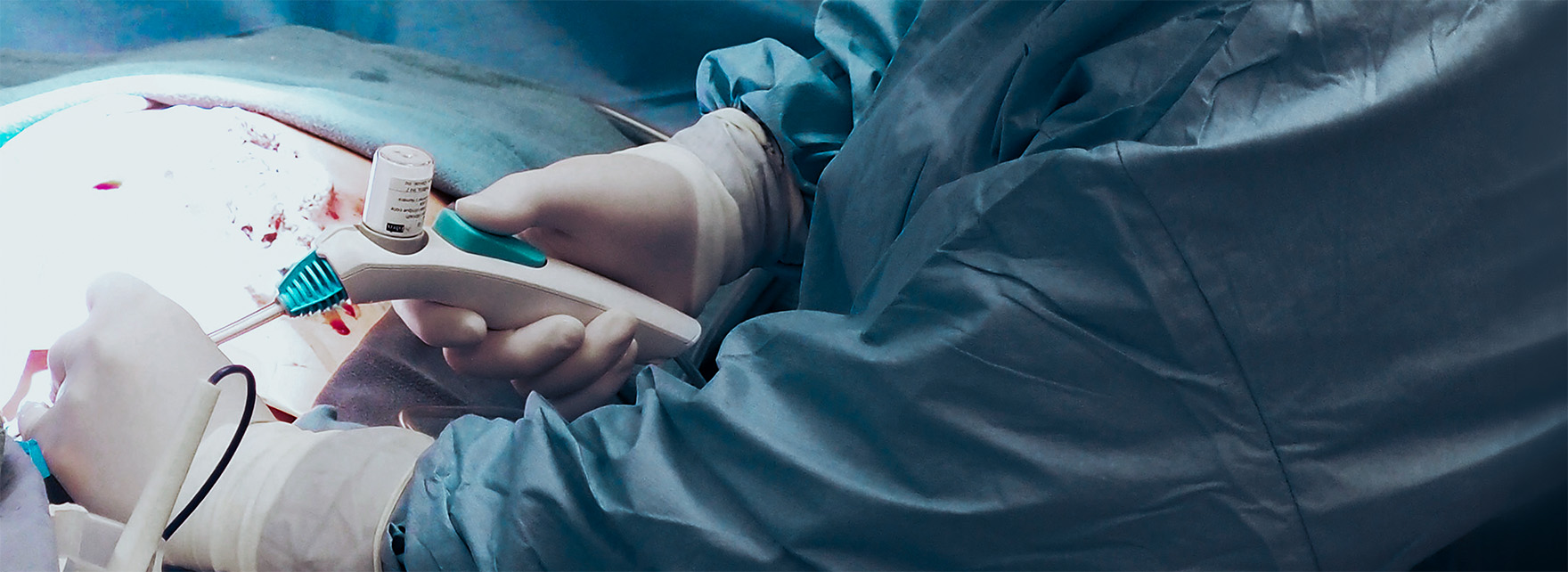Surgical device development | Team Consulting