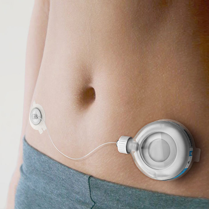 Drug delivery device development | Team Consulting