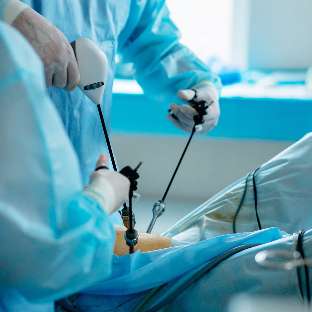 surgeons using laparoscopic device during surgery image