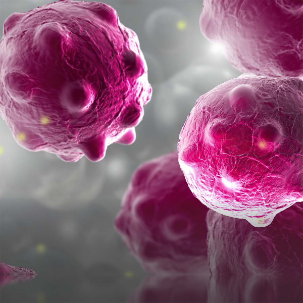 tumor cells