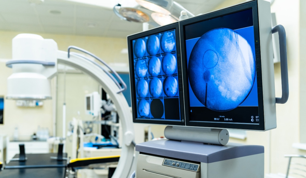 X ray scanning for tumours