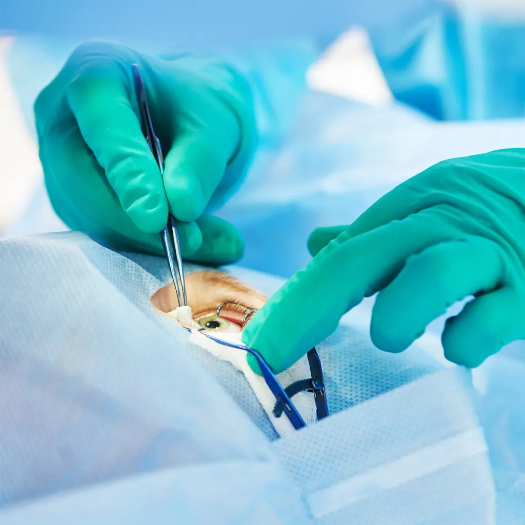 Gloved-hands-holding-tweezers-above-an-eye-1024x1024.jpg